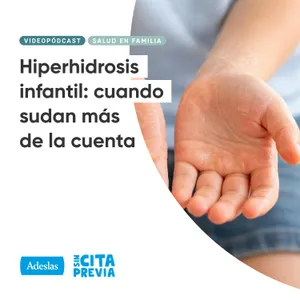 Hiperhidrosis infantil: cuando sudan más de la cuenta