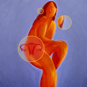 Can a name change transform PCOS outcomes for women?