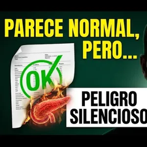 323. Por qué acumulas AZUCAR aunque no comas dulces (y por qué es PELIGROSO)