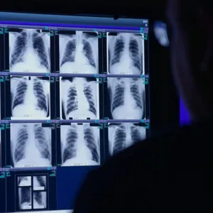 The black lung crisis deepens in Appalachia