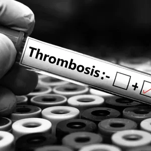 What exactly is thrombosis?