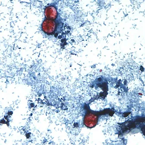 How Trump made it harder to fight the cyclospora parasite outbreak