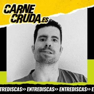 Ugo sin Hache: “¿Cuánta gente con discapacidad ves en la tele?” (ENTREDISCAS - CARNE CRUDA #1700)