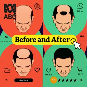 01 Before and After | The cost of keeping your hair
