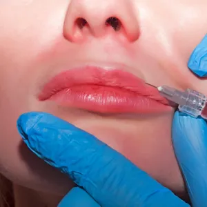 The pressure to change your face