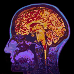 The incredible science of memory manipulation
