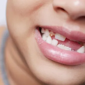 Mesa de redacción: ¿Guardas los dientes de leche de tus hijos?